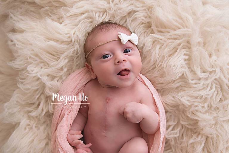 awake newborn girl with scar from heart surgery in nh newborn session